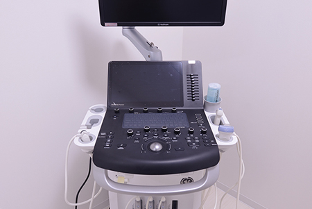 超音波診断装置